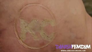 burnmarked and whippped.-4