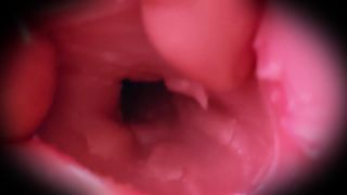 Zoom In On The Gaping Anal Of A Busty Girl! Lewd Intestinal Walls Are E.-2
