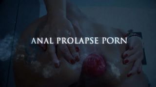 Really unique amateur double anal fisting to Prolapse - fisting - fisting porn videos russian amateur home-9