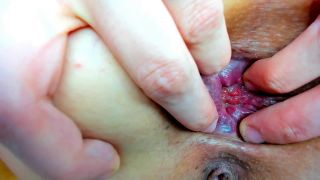 Anal stretching - AmeliaLiddell extreme Gaping - So Deep.-9